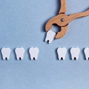 Play teeth and pliers removing at tooth